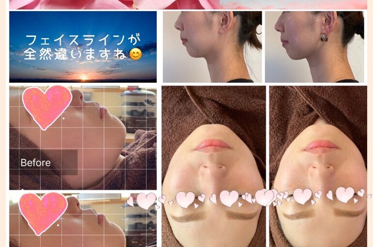 R様ビフォアフ